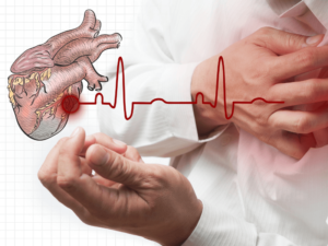 Suy tim mãn tính: Dấu hiệu cảnh báo và cách điều trị