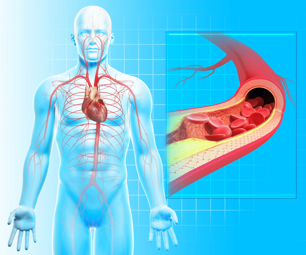 Tác động của huyết áp cao đến sức khỏe tim mạch