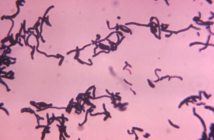 Vi khuẩn Corynebacterium diphtheriae