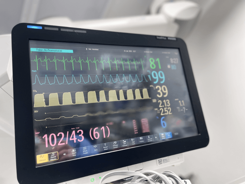 Kỹ thuật ghi điện tâm đồ theo dõi tại nhà (Holter)